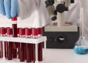 Seis pessoas infetadas com ‘legionella’ em Viana do Castelo