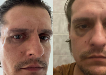 “És tu o ator violador?” Carloto Cotta espancado em Lisboa