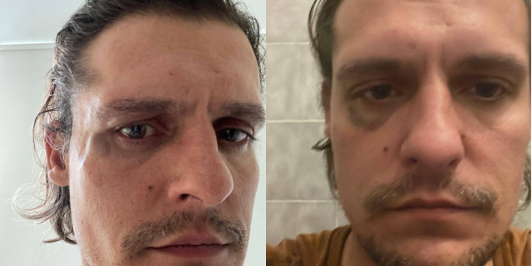 “És tu o ator violador?” Carloto Cotta espancado em Lisboa